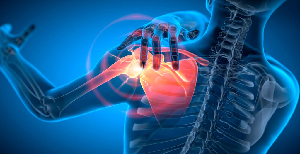 Shoulder Replacement & Open Surgery